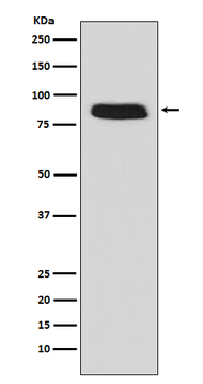 GCSF Receptor (CD114) Rabbit mAb Antibody