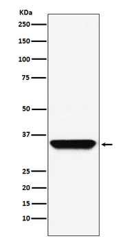 ADORA1 Rabbit mAb Antibody