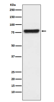 KLKB1 Rabbit mAb Antibody