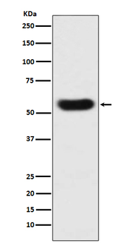 SERPINC1 Rabbit Monoclonal Antibody