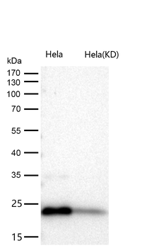 DHFR Rabbit mAb [KD Validated] Antibody