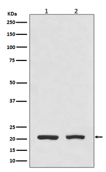 DHFR Rabbit mAb [KD Validated] Antibody