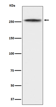 CHD3 Rabbit mAb [KD Validated]