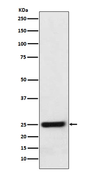 ERAB Rabbit Monoclonal Antibody