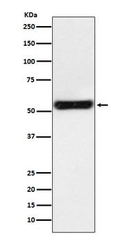 PTGER2 Rabbit mAb Antibody