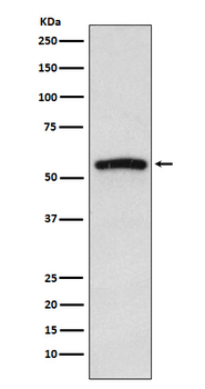 IRAK4 Rabbit Monoclonal Antibody