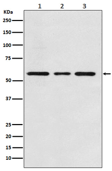ACVRL1 Rabbit mAb Antibody