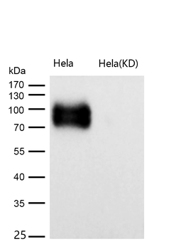 CD276 Rabbit mAb Antibody