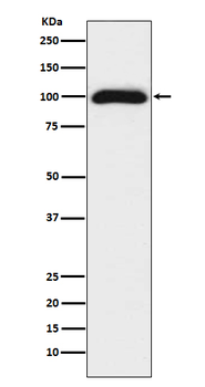 CD276 Rabbit mAb Antibody