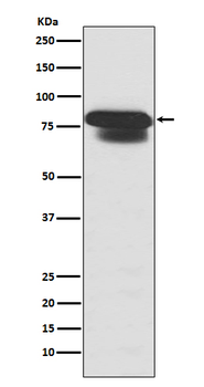 PIAS1 + PIAS2 Rabbit mAb