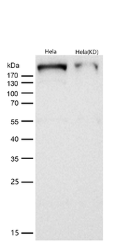 CHD4 Rabbit mAb [KD Validated] Antibody
