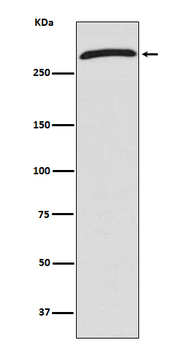 CHD4 Rabbit mAb [KD Validated] Antibody