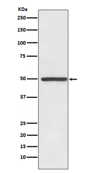 Dopamine Transporter Rabbit mAb Antibody