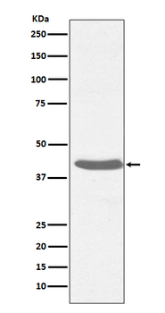 MHC class I Rabbit mAb Antibody