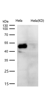 TGF beta 1 Rabbit mAb [KD Validated] Antibody