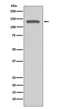 iNOS Rabbit mAb Antibody