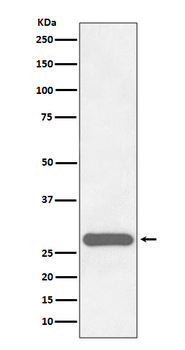 CITED2 Rabbit Monoclonal Antibody