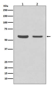 AKT1/2 Rabbit mAb Antibody