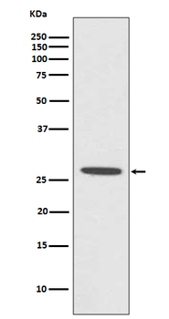 CDCA3 Rabbit mAb Antibody