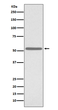 Cdc25C Rabbit mAb [KD Validated]