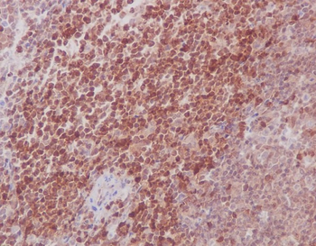 MEK3/MEK6 Rabbit mAb