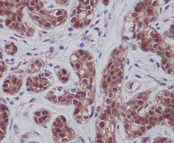 STAT5A/B Rabbit mAb Antibody