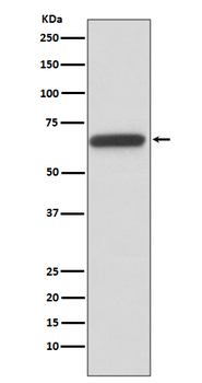 HNF1 beta Rabbit Monoclonal Antibody