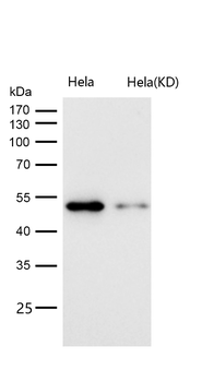 Cyclin A1/A2 Rabbit mAb [KD Validated]