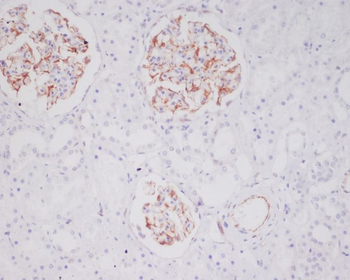 Mast Cell Tryptase Rabbit mAb Antibody