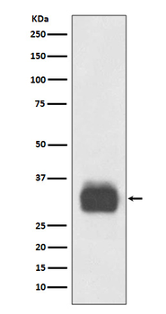 Mast Cell Tryptase Rabbit mAb Antibody