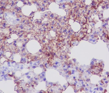 AQP5 Rabbit mAb Antibody