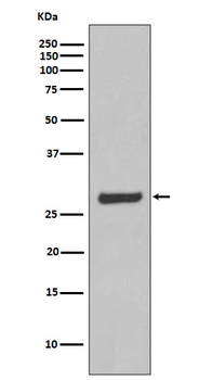 AQP5 Rabbit mAb Antibody