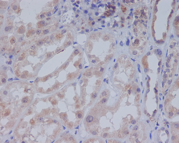 Acetyl-CoA Carboxylase Rabbit Monoclonal Antibody
