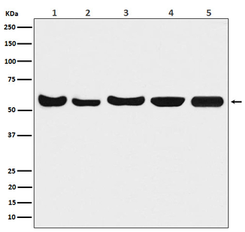Akt(pan) 1/2/3 Rabbit mAb