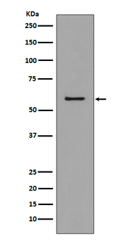 CCR3 Rabbit mAb