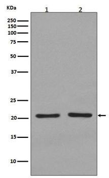 KRAS+HRAS+NRAS Rabbit mAb Antibody