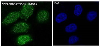 KRAS+HRAS+NRAS Rabbit mAb Antibody