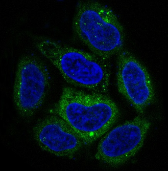 p62/SQSTM1 Rabbit mAb Antibody