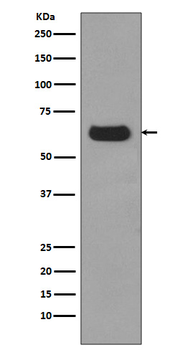 p62/SQSTM1 Rabbit mAb Antibody
