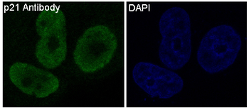 p21 Rabbit mAb Antibody