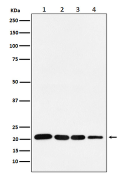 p21 Rabbit mAb Antibody