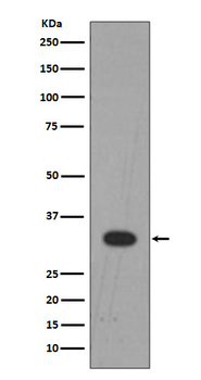Lin28B Rabbit mAb