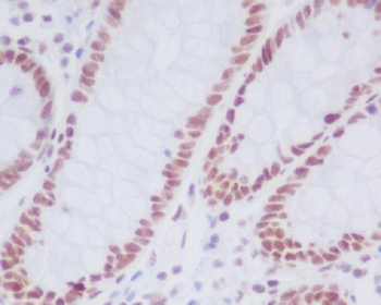 KDM1/LSD1 Rabbit mAb Antibody