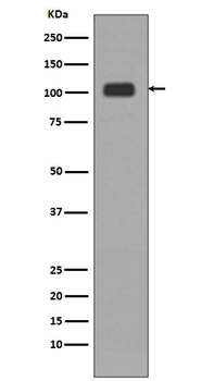 KDM1/LSD1 Rabbit mAb Antibody