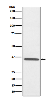 Fibrillarin Rabbit mAb