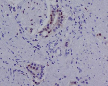 Androgen Receptor(AR-V7 specific) Rabbit mAb Antibody