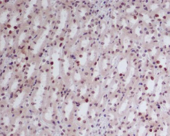 GATA2/3 Rabbit mAb Antibody