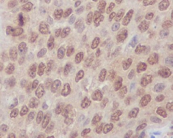 Rho A + B + C Rabbit mAb Antibody