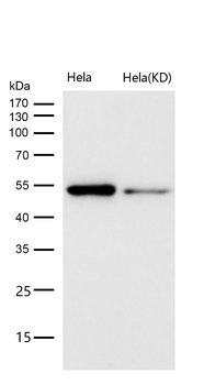 Caspase-2 Rabbit mAb [KD Validated]