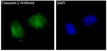 Caspase-2 Rabbit mAb [KD Validated]